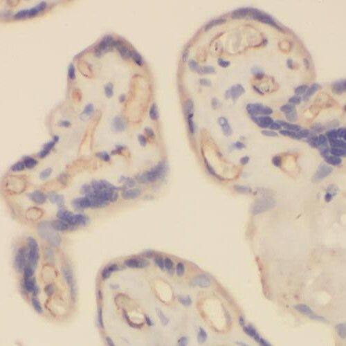 RHOBTB3 Antibody - BSA Free