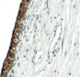 Uroplakin II Antibody - BSA Free