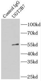 UGT2B7 Antibody - BSA Free