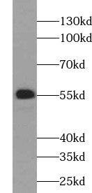 UGT2B4 Antibody - BSA Free