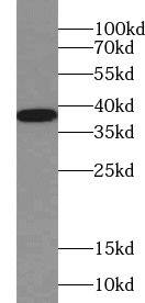 UCP5 Antibody - BSA Free