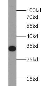 UCK Antibody - BSA Free