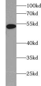 UBXD5 Antibody - BSA Free