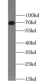 UBQLNL Antibody - BSA Free