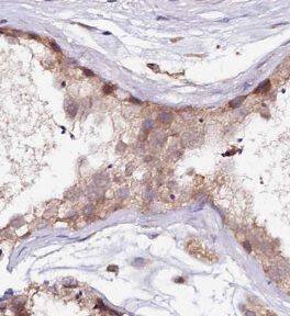 UBN2 Antibody - BSA Free