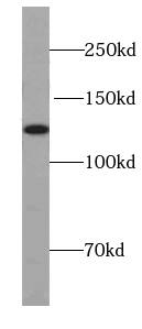 UBN1 Antibody - BSA Free