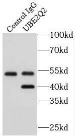 UBE2Q2 Antibody - BSA Free