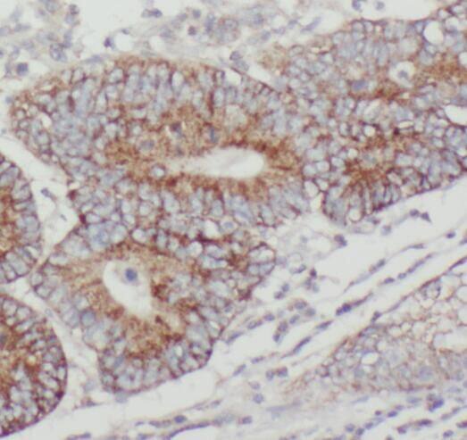 PTPN23 Antibody - BSA Free