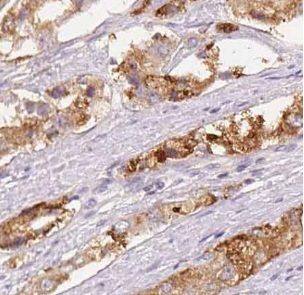 UbcH5c/UBE2D3 Antibody - BSA Free