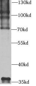 Ubiquitin C Antibody - BSA Free