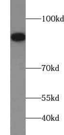 SAE2 Antibody - BSA Free