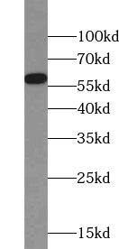 UAP1L1 Antibody - BSA Free