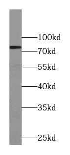 TYW1B Antibody - BSA Free