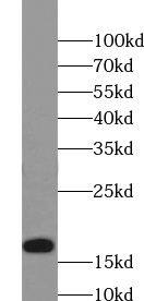 TXNL4B Antibody - BSA Free