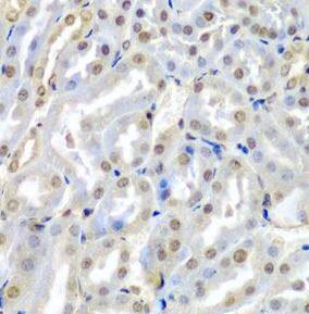 TUSC2 Antibody - BSA Free