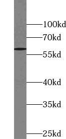 TULP3 Antibody - BSA Free