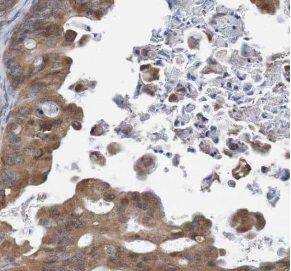 TULP3 Antibody - BSA Free