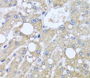 TUBGCP3 Antibody - BSA Free