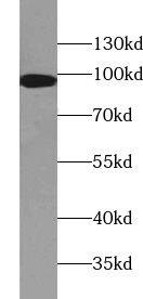 TTC7A Antibody - BSA Free