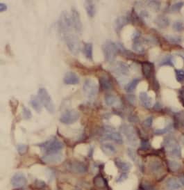 TTC39A Antibody - BSA Free