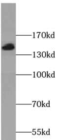 TTC37 Antibody - BSA Free