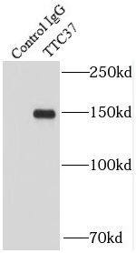 TTC37 Antibody - BSA Free