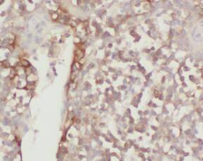 TTC37 Antibody - BSA Free