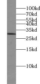 TTC32 Antibody - BSA Free