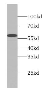 TTC31 Antibody - BSA Free