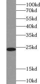 TSR2 Antibody - BSA Free