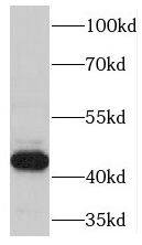 TSPYL4 Antibody - BSA Free
