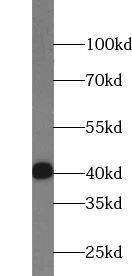 TSPY3 Antibody - BSA Free