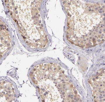 TSPY3 Antibody - BSA Free