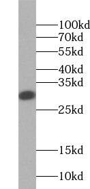 TSPAN6 Antibody - BSA Free