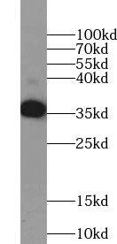 TSPAN11 Antibody - BSA Free