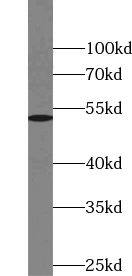 TSEN2 Antibody - BSA Free