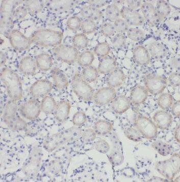 TRUB1 Antibody - BSA Free