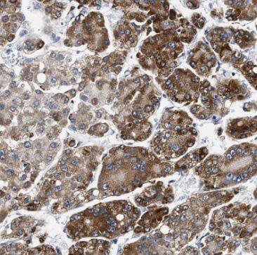 TRPT1 Antibody - BSA Free