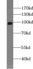 TRPM5 Antibody - BSA Free