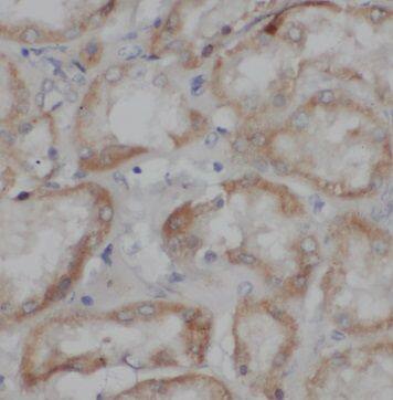 TRPC4 Antibody - BSA Free
