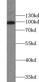 TRPC4 Antibody - BSA Free