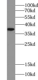 TRSPAP1 Antibody - BSA Free