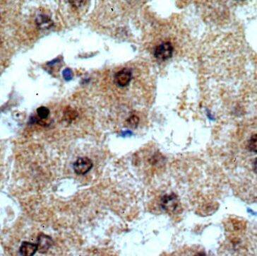 TRSPAP1 Antibody - BSA Free