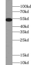 TRMT5 Antibody - BSA Free