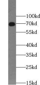 TRIM67 Antibody - BSA Free