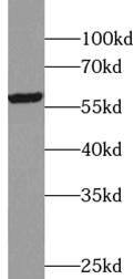 RNF89 Antibody - BSA Free