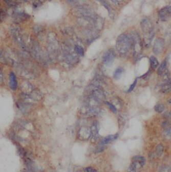 RNF89 Antibody - BSA Free