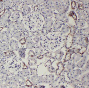 TRIM2 Antibody - BSA Free
