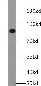 TRIM2 Antibody - BSA Free