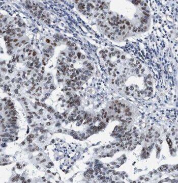 Trim11 Antibody - BSA Free